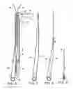 Fig. 04 - Method and surgical instrument operable for percutaneous ligation of a vein or vessel