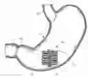 Application 20070198039, fig. 01
