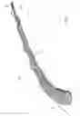Fig. 03 - Intragastric device for treating obesity