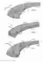 Fig. 05 - Intragastric device for treating obesity