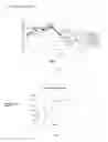 Fig. 02 - Temporarily stiffened mesh prostheses