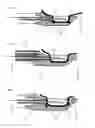 Fig. 04 - Tissue Or Organ Manipulation Device