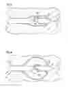 Fig. 03 - Surgical visualization tool