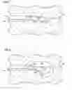 Fig. 05 - Surgical visualization tool