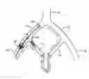 Fig. 01 - Devices and methods for preventing distal embolization using flow reversal in arteries having collateral blood flow