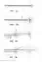 Fig. 02 - Devices and methods for preventing distal embolization using flow reversal in arteries having collateral blood flow