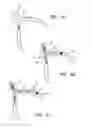 Fig. 05 - Devices and methods for preventing distal embolization using flow reversal in arteries having collateral blood flow