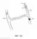 Fig. 08 - Devices and methods for preventing distal embolization using flow reversal in arteries having collateral blood flow