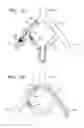 Fig. 09 - Devices and methods for preventing distal embolization using flow reversal in arteries having collateral blood flow