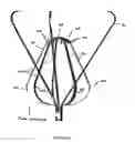 Fig. 10 - Medical implant device