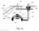 Fig. 12 - Device and method for maintaining pressure onto a blood vessel