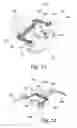 Fig. 13 - Device and method for maintaining pressure onto a blood vessel