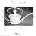 Fig. 19 - Device and method for maintaining pressure onto a blood vessel