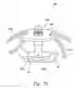 Fig. 22 - Device and method for maintaining pressure onto a blood vessel