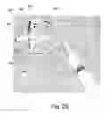 Fig. 25 - Device and method for maintaining pressure onto a blood vessel