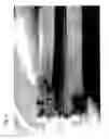 Fig. 09 - Cuff member