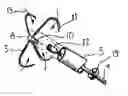Fig. 01 - Method and device for closing holes in tissue