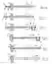 Fig. 03 - Method and device for closing holes in tissue