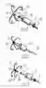 Fig. 04 - Method and device for closing holes in tissue