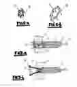Fig. 05 - Method and device for closing holes in tissue