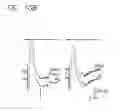 Fig. 14 - Method and apparatus for visual neural stimulation