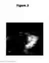 Fig. 04 - TREATMENT OF VITILIGO