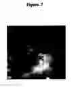 Fig. 08 - TREATMENT OF VITILIGO