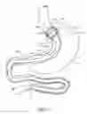 Fig. 02 - Devices and methods for endolumenal gastrointestinal bypass