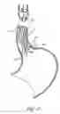 Fig. 12 - Devices and methods for endolumenal gastrointestinal bypass
