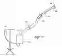 Fig. 17 - Devices and methods for endolumenal gastrointestinal bypass