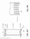 Fig. 29 - Devices and methods for endolumenal gastrointestinal bypass