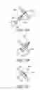 Fig. 52 - Devices and methods for endolumenal gastrointestinal bypass