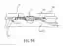 Fig. 12 - Device for rapid repair of body conduits