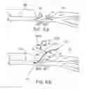 Fig. 13 - Device for rapid repair of body conduits