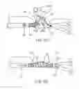 Fig. 14 - Device for rapid repair of body conduits