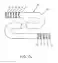Fig. 15 - Device for rapid repair of body conduits