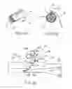 Fig. 17 - Device for rapid repair of body conduits