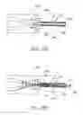 Fig. 25 - Device for rapid repair of body conduits
