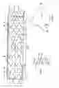 Fig. 02 - Delivery system and method for self-centering a Proximal end of a stent graft