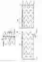 Fig. 04 - Delivery system and method for self-centering a Proximal end of a stent graft