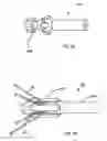 Fig. 10 - Delivery system and method for self-centering a Proximal end of a stent graft
