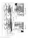 Fig. 27 - Delivery system and method for self-centering a Proximal end of a stent graft