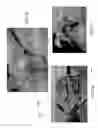 Fig. 28 - Delivery system and method for self-centering a Proximal end of a stent graft