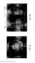 Fig. 29 - Delivery system and method for self-centering a Proximal end of a stent graft