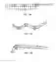 Fig. 56 - Delivery system and method for self-centering a Proximal end of a stent graft