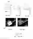 Fig. 57 - Delivery system and method for self-centering a Proximal end of a stent graft