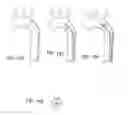 Fig. 58 - Delivery system and method for self-centering a Proximal end of a stent graft