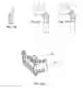 Fig. 59 - Delivery system and method for self-centering a Proximal end of a stent graft
