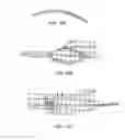 Fig. 62 - Delivery system and method for self-centering a Proximal end of a stent graft