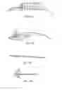 Fig. 63 - Delivery system and method for self-centering a Proximal end of a stent graft
